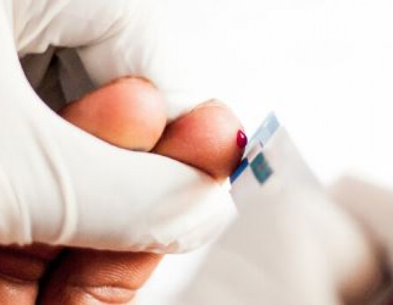HIV, STIs, Hepatitis C Testing